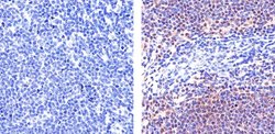 Invitrogen STAT6 Recombinant Rabbit Monoclonal Antibody (21HCLC) 100 &mu;g;