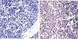 Invitrogen STAT6 Recombinant Rabbit Monoclonal Antibody (21HCLC) 100 &mu;g;