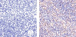 Invitrogen STAT6 Recombinant Rabbit Monoclonal Antibody (21HCLC) 100 &mu;g;