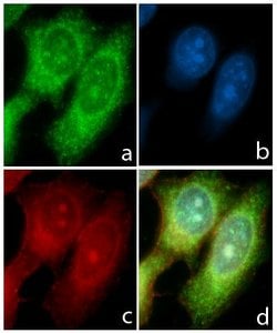 Invitrogen STAT6 Recombinant Rabbit Monoclonal Antibody (21HCLC) 100 &mu;g;