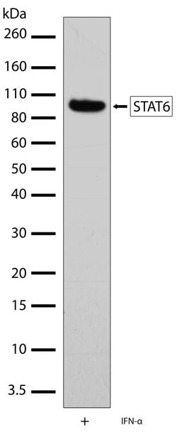 Invitrogen STAT6 Recombinant Rabbit Monoclonal Antibody (21HCLC) 100 &mu;g;