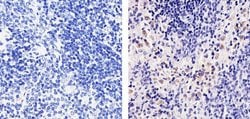 Invitrogen CXCL2 Recombinant Rabbit Monoclonal Antibody (16H3L10) 100 &mu;g;