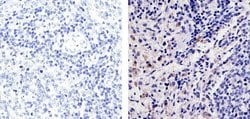 Invitrogen CXCL2 Recombinant Rabbit Monoclonal Antibody (16H3L10) 100 &mu;g;