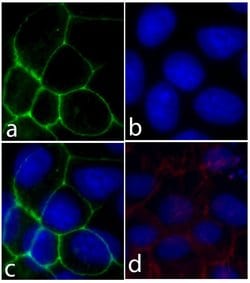 Invitrogen E-cadherin Recombinant Rabbit Monoclonal Antibody (5H6L18) 100