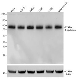 Invitrogen E-cadherin Recombinant Rabbit Monoclonal Antibody (5H6L18) 100