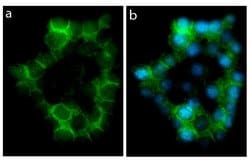 Invitrogen E-cadherin Recombinant Rabbit Monoclonal Antibody (5H6L18) 100
