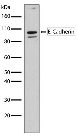 Invitrogen E-cadherin Recombinant Rabbit Monoclonal Antibody (5H6L18) 100