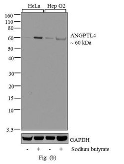 Invitrogen ANGPTL4 Recombinant Rabbit Monoclonal Antibody (1H12L19) 100