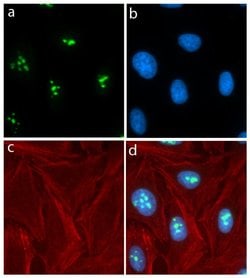 Invitrogen Nucleostemin Recombinant Rabbit Monoclonal Antibody (3H20L2)