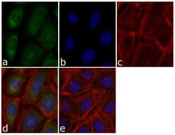Invitrogen Metadherin Recombinant Rabbit Monoclonal Antibody (21H9L18) 100 &mu;g | Buy Online | Invitrogen&trade; | Fisher Scientific