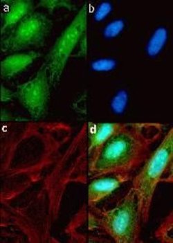 Invitrogen Metadherin Recombinant Rabbit Monoclonal Antibody (21H9L18) 100 &mu;g | Buy Online | Invitrogen&trade; | Fisher Scientific