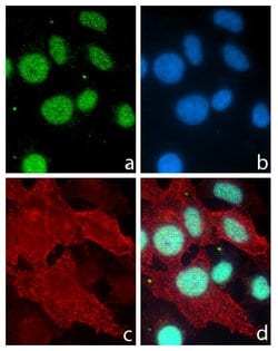 Invitrogen PITX3 Recombinant Rabbit Monoclonal Antibody (5H10L5) 100 &mu;g;