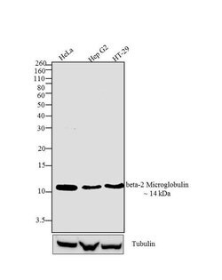 Invitrogen beta-2 Microglobulin Recombinant Rabbit Monoclonal Antibody