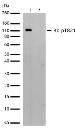 Invitrogen Phospho-Rb (Thr821) Recombinant Rabbit Monoclonal Antibody (16H2L1)