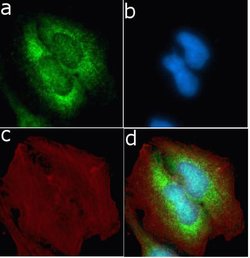 Invitrogen TIMP4 Recombinant Rabbit Monoclonal Antibody (13H4L13) 100 &mu;g;