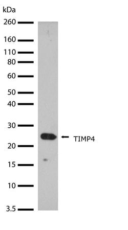 Invitrogen TIMP4 Recombinant Rabbit Monoclonal Antibody (13H4L13) 100 &mu;g;