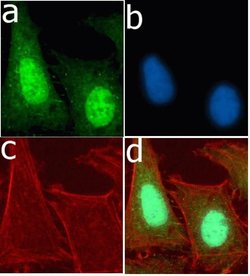 Invitrogen Ubiquitin Recombinant Rabbit Monoclonal Antibody (10H4L21) 100