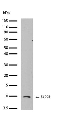 Invitrogen S100B Recombinant Rabbit Monoclonal Antibody (16H24L21) 100