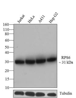 Invitrogen S6 Recombinant Rabbit Monoclonal Antibody (9H8L2) 100 &mu;g;