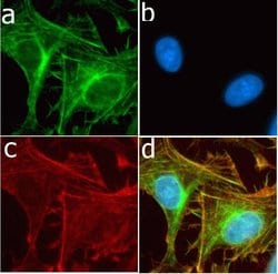 Invitrogen CD56 Recombinant Rabbit Monoclonal Antibody (3H15L12) 100 &mu;g;