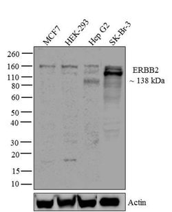 Invitrogen ErbB2 (HER-2) Recombinant Rabbit Monoclonal Antibody (7H3L20)