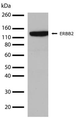 Invitrogen ErbB2 (HER-2) Recombinant Rabbit Monoclonal Antibody (7H3L20)