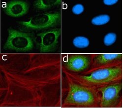 Invitrogen SHH Recombinant Rabbit Monoclonal Antibody (23H15L1) 100 &mu;g;