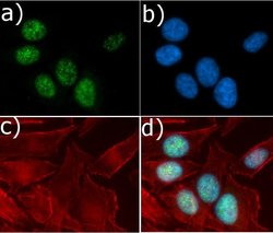 Invitrogen Cyclin D1 Recombinant Rabbit Monoclonal Antibody (17H3L3) 100