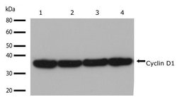 Invitrogen Cyclin D1 Recombinant Rabbit Monoclonal Antibody (17H3L3) 100