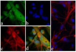 Alpha-Smooth Muscle Actin Recombinant Rabbit Monoclonal Antibody (17H19L35), Invitrogen™
