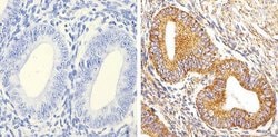 Invitrogen Alpha-Smooth Muscle Actin Recombinant Rabbit Monoclonal Antibody
