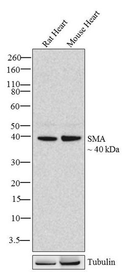 Invitrogen Alpha-Smooth Muscle Actin Recombinant Rabbit Monoclonal Antibody