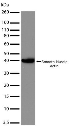 Invitrogen Alpha-Smooth Muscle Actin Recombinant Rabbit Monoclonal Antibody
