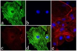 Invitrogen&trade;&nbsp;Troponin I Recombinant Rabbit Monoclonal Antibody (1H11L19)