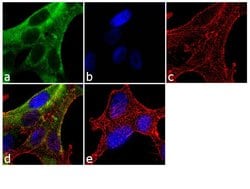 Invitrogen&trade;&nbsp;PSA Recombinant Rabbit Monoclonal Antibody (4H23L24)