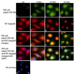 Phospho-IKK alpha/beta (Ser176, Ser180) Recombinant Rabbit Monoclonal Antibody