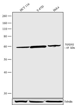Invitrogen TGFBR2 Recombinant Rabbit Monoclonal Antibody (16H2L4) 100 &mu;g;