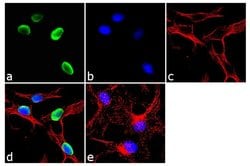 Invitrogen FOXA2 Recombinant Rabbit Monoclonal Antibody (9H5L7) 100 &mu;g;