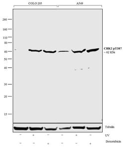 Invitrogen Phospho-CHK2 (Thr387) Recombinant Rabbit Monoclonal Antibody (45H21L9) 100 &mu;g | Buy Online | Invitrogen&trade; | Fisher Scientific