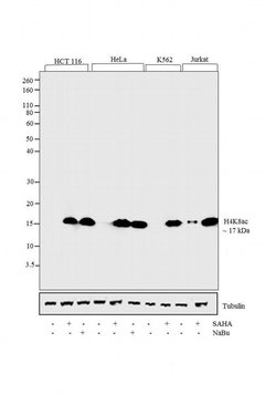 Invitrogen H4K8ac Recombinant Rabbit Monoclonal Antibody (8H5L4), ChIP-Verified 100 &mu;g | Buy Online | Invitrogen&trade; | Fisher Scientific