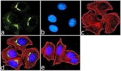 Invitrogen&trade;&nbsp;Syntaxin 6 Recombinant Rabbit Monoclonal Antibody (821L4)