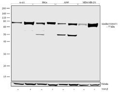 Kindlin Recombinant Rabbit Monoclonal Antibody (7H7L9):Antibodies, Recombinant
