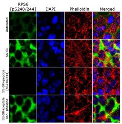 Invitrogen Phospho-S6 (Ser240, Ser244) Recombinant Rabbit Monoclonal Antibody
