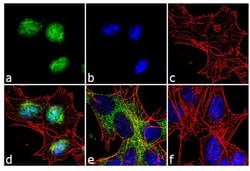 Invitrogen FOXO3A Recombinant Rabbit Monoclonal Antibody (5H17L19) 100