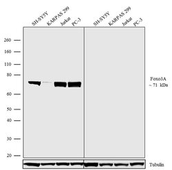Invitrogen FOXO3A Recombinant Rabbit Monoclonal Antibody (5H17L19) 100
