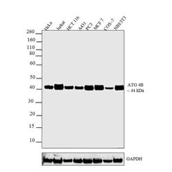 ATG4B Recombinant Rabbit Monoclonal Antibody (1HC6LC10):Antibodies, Recombinant