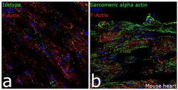 Invitrogen alpha Actinin 2 Recombinant Rabbit Monoclonal Antibody (7H1L69)