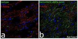 Invitrogen alpha Actinin 2 Recombinant Rabbit Monoclonal Antibody (7H1L69)