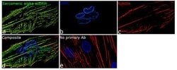Invitrogen alpha Actinin 2 Recombinant Rabbit Monoclonal Antibody (7H1L69)