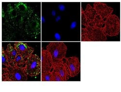 Invitrogen SMAD7 Recombinant Rabbit Monoclonal Antibody (17H18L23) 100